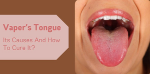 Vaper’s Tongue: Its Causes And How To Cure It?